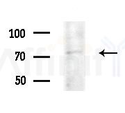 UBQLN3 Antibody - Western blot analysis of lysates from HepG2 cells(LPS 4h treatment), using UBQLN3 Antibody at 1/1000 dilution.