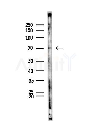 UBQLN3 Antibody - Western blot analysis of lysates from HepG2 cells(LPS,4h treatment), using UBQLN3 Antibody at 1/1000 dilution.