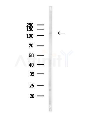 USP11 Antibody - Western blot analysis of lysates from Hela cells(heat-shock,45min treatment), using USP11 Antibody at 1/1000 dilution.