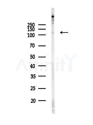 USP11 Antibody - Western blot analysis of lysates from HepG2 cells(heat-shock,45min treatment), using USP11 Antibody at 1/1000 dilution.