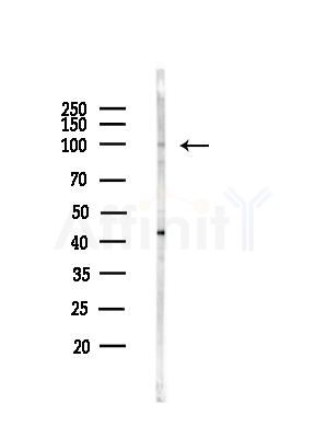 USP13 Antibody - Western blot analysis of lysates from COLO205 cells, using USP13 Antibody at 1/1000 dilution.