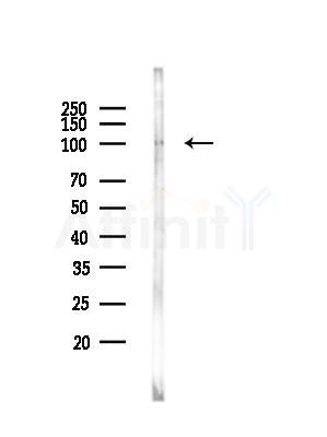 USP13 Antibody - Western blot analysis of lysates from HUVEC cells, using USP13 Antibody at 1/1000 dilution.