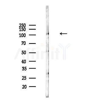 USP15 Antibody - Western blot analysis of lysates from Hela cells(heat-shock,45min treatment), using USP15 Antibody at 1/1000 dilution.