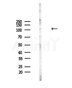 USP15 Antibody - Western blot analysis of lysates from PC12 cells(starvation,24h treatment), using USP15 Antibody at 1/1000 dilution.