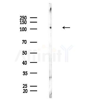 USP15 Antibody - Western blot analysis of lysates from Mouse brain, using USP15 Antibody at 1/1000 dilution.