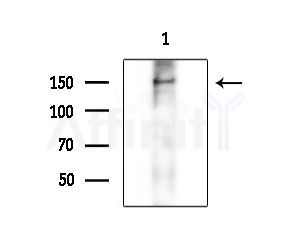 USP19 Antibody - Western blot analysis of extracts from COLO205 cells, using USP19 Antibody at 1/1000 dilution.