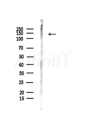 USP19 Antibody - Western blot analysis of lysates from COLO205 cells, using USP19 Antibody at 1/1000 dilution.