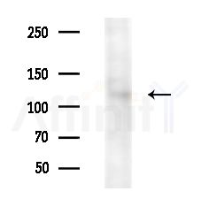 USP42 Antibody - Western blot analysis of extracts from Mouse liver, using USP42 Antibody at 1/1000 dilution.