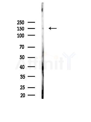 USP42 Antibody - Western blot analysis of lysates from Mouse liver, using USP42 Antibody at 1/1000 dilution.
