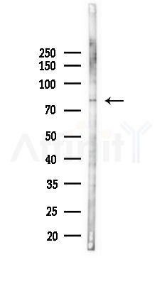 USP45 Antibody - Western blot analysis of lysates from Hela cells(heat-shock,45min treatment), using USP45 Antibody at 1/1000 dilution.