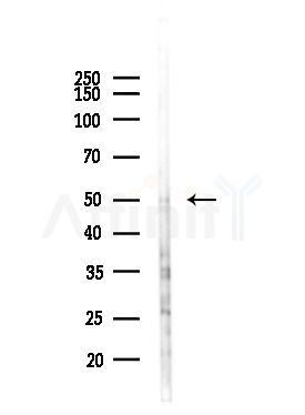 UBFD1 Antibody - Western blot analysis of lysates from EC304 cells(heat-shock,45min treatment), using UBFD1 Antibody at 1/1000 dilution.