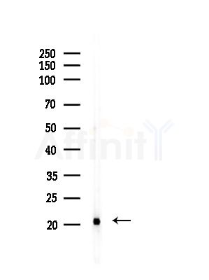 UBE2D2 Antibody - Western blot analysis of lysates from A375 cells(LPS, 4h treatment), using UBE2D2 Antibody at 1/1000 dilution.