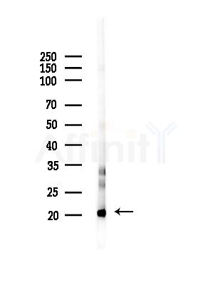 UBE2D2 Antibody - Western blot analysis of lysates from RAW264.