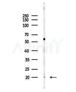 UBE2T Antibody - Western blot analysis of lysates from MDA-MB-231 cells, using UBE2T Antibody at 1/1000 dilution.