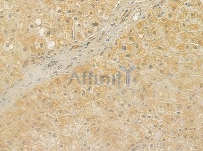 UEVLD Antibody - DF4602 at 1/100 staining human normal liver tissue by IHC-P.