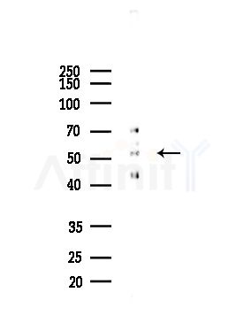 UGDH Antibody - Western blot analysis of lysates from Mouse lung, using UGDH Antibody at 1/1000 dilution.