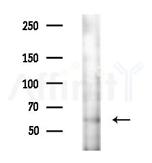 ATP6V1B1 Antibody - Western blot analysis of lysates from EC304 cells(heat-shock,45min treatment), using ATP6V1B1 Antibody at 1/1000 dilution.
