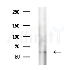 ATP6V1B1 Antibody - Western blot analysis of lysates from B16F10-LUC cells(starvation,24h treatment), using ATP6V1B1 Antibody at 1/1000 dilution.