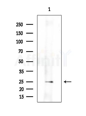 SFT2B Antibody - Western blot analysis of extracts from HUVEC cells, using SFT2B Antibody at 1/1000 dilution.