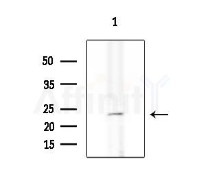 SFT2B Antibody - Western blot analysis of extracts from Rat brain, using SFT2B Antibody at 1/1000 dilution.