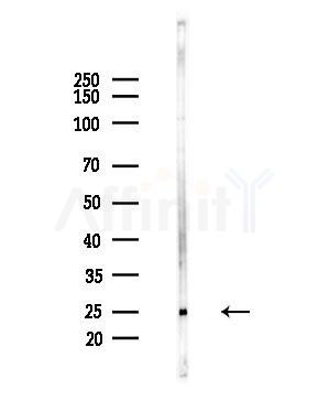 CACNG1 Antibody - Western blot analysis of lysates from LoVo cells(heat-shock,45min treatment), using CACNG1 Antibody at 1/1000 dilution.