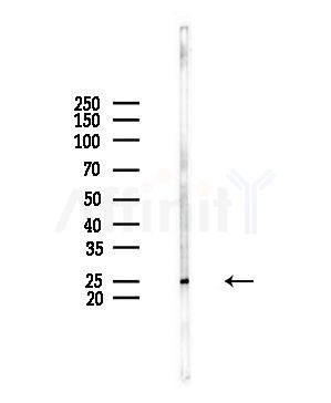 CACNG1 Antibody - Western blot analysis of lysates from HUVEC cells(UV,30min treatment), using CACNG1 Antibody at 1/1000 dilution.