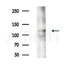 CACNA2D4 Antibody - Western blot analysis of lysates from EC304 cells(heat-shock,45min treatment), using CACNA2D4 Antibody at 1/1000 dilution.