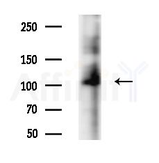 CACNA2D4 Antibody - Western blot analysis of lysates from B16F10-LUC cells(starvation,24h treatment), using CACNA2D4 Antibody at 1/1000 dilution.