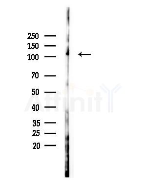 CACNA2D4 Antibody - Western blot analysis of lysates from B16F10-LUC cells(starvation,24h treatment), using CACNA2D4 Antibody at 1/1000 dilution.