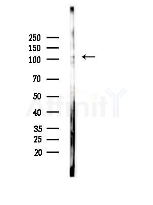 CACNA2D4 Antibody - Western blot analysis of lysates from EC304 cells(heat-shock,45min treatment), using CACNA2D4 Antibody at 1/1000 dilution.
