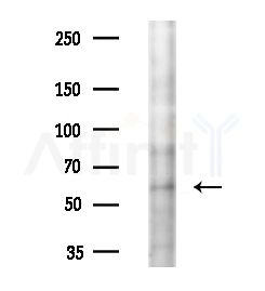 WEE2 Antibody - Western blot analysis of extracts from EC304 cells(heat-shock,45min treatment), using WEE2 Antibody at 1/1000 dilution.