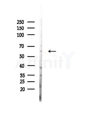 WEE2 Antibody - Western blot analysis of lysates from EC304 cells(heat-shock,45min treatment), using WEE2 Antibody at 1/1000 dilution.