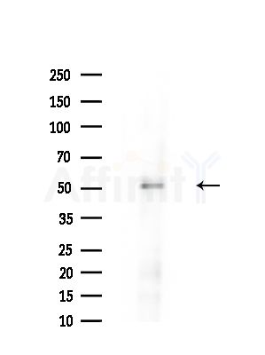 WASF3 Antibody - Western blot analysis of extracts from HUVEC cells(starvation,24h treatment), using WASF3 Antibody at 1/1000 dilution.