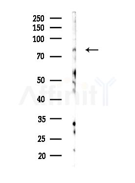 ZNF420 Antibody - Western blot analysis of lysates from MDA-MB-231 cells(heat-shock,45min treatment), using ZNF420 Antibody at 1/1000 dilution.