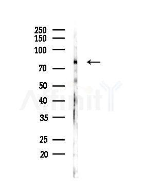 ZNF420 Antibody - Western blot analysis of lysates from LOV0(heat-shock,45min treatment), using ZNF420 Antibody at 1/1000 dilution.