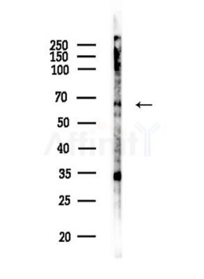 ZNF460 Antibody - Western blot analysis of lysates from COLO205 cells, using ZNF460 Antibody at 1/1000 dilution.