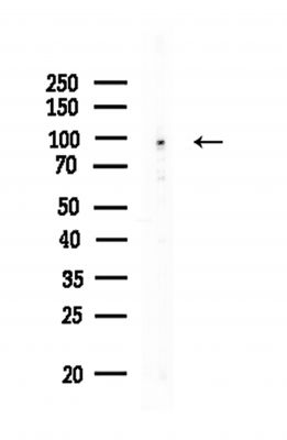 ZZZ3 Antibody - Western blot analysis of lysates from HUVEC cells, using ZZZ3 Antibody at 1/1000 dilution.