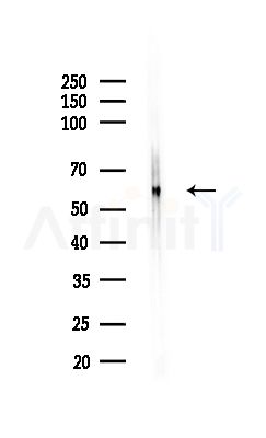 SLC30A1 Antibody - Western blot analysis of lysates from Rat lung, using SLC30A1 Antibody at 1/1000 dilution.