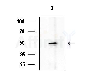 SLC30A9 Antibody - Western blot analysis of extracts from EC304 cells, using SLC30A9 Antibody at 1/1000 dilution.