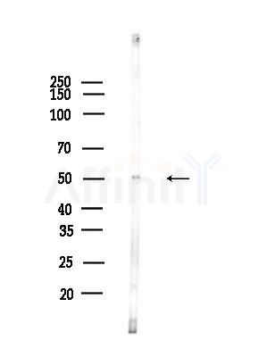 SLC30A9 Antibody - Western blot analysis of lysates from K562 cells(heat-shock,45min treatment), using SLC30A9 Antibody at 1/1000 dilution.