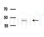 ZIP7 Antibody - Western blot analysis of extracts from Rat brain, using ZIP7 Antibody at 1/1000 dilution.