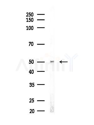 ZIP7 Antibody - Western blot analysis of lysates from Rat brain, using ZIP7 Antibody at 1/1000 dilution.