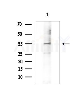 SLC39A9 Antibody - Western blot analysis of extracts from COLO205 cells, using SLC39A9 Antibody at 1/1000 dilution.