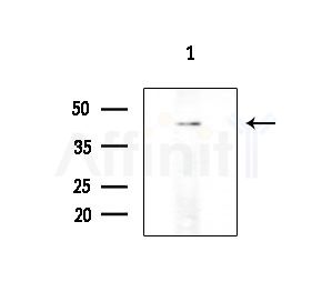 SLC39A1 Antibody - Western blot analysis of extracts from PC12 cells(LPS 4h treatment), using SLC39A1 Antibody at 1/1000 dilution.