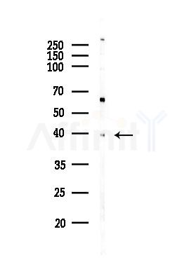 SLC39A1 Antibody - Western blot analysis of lysates from PC12 cells(LPS,4h treatment), using SLC39A1 Antibody at 1/1000 dilution.