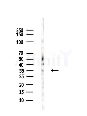 ZADH1 Antibody - Western blot analysis of lysates from COLO205 cells(UV,30min treatment), using ZADH1 Antibody at 1/1000 dilution.