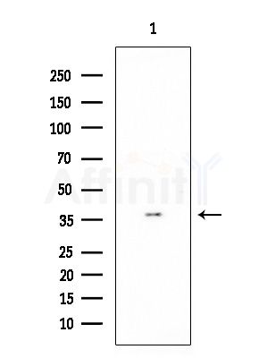 RNF130 Antibody - Western blot analysis of extracts from COLO205 cells, using RNF130 Antibody at 1/1000 dilution.
