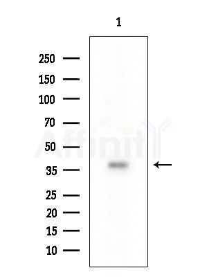 RNF130 Antibody - Western blot analysis of extracts from HUVEC cells, using RNF130 Antibody at 1/1000 dilution.