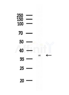 RNF130 Antibody - Western blot analysis of lysates from COLO205 cells, using RNF130 Antibody at 1/1000 dilution.