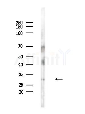 SMUG1 Antibody - Western blot analysis of lysates from EC304 cells(heat-shock,45min treatment), using SMUG1 Antibody at 1/1000 dilution.
